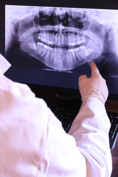 Best Knocked-Out Tooth Emergency  in Lewistown, PA